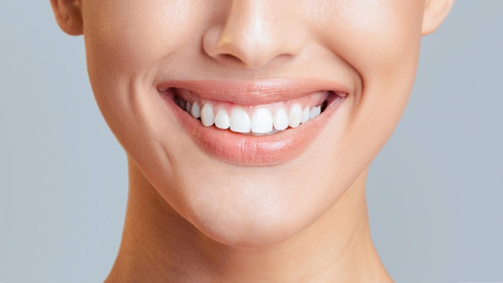 Teeth Whitening in Durham: How to Get a Brighter Smile Without Sensitivity